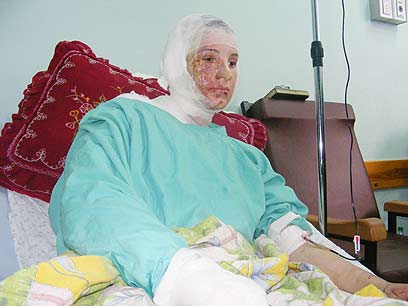 ר'אדה אבו חלימה (20), זמן קצר לפני מותה. תצלום: מוחמד סבאח, "בצלם"